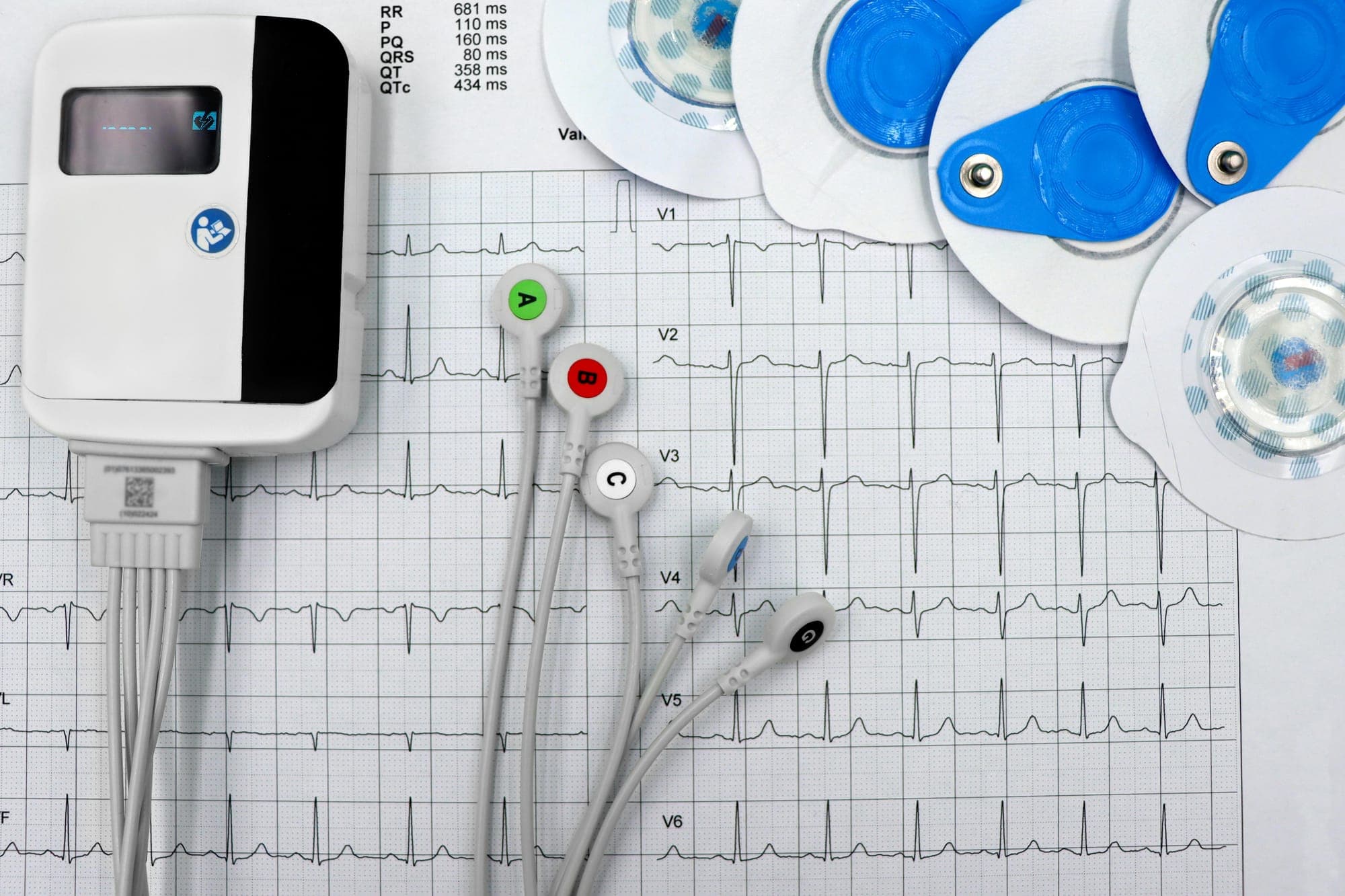 Can Medical Assistants Do EKGs?